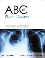 ABC of Pleural Diseases (PDF eBook)